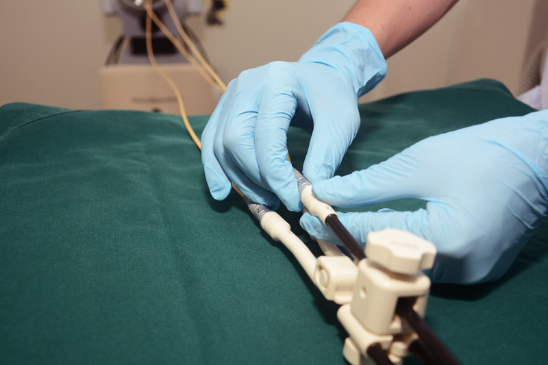 Cervical Brachytherapy Procedure