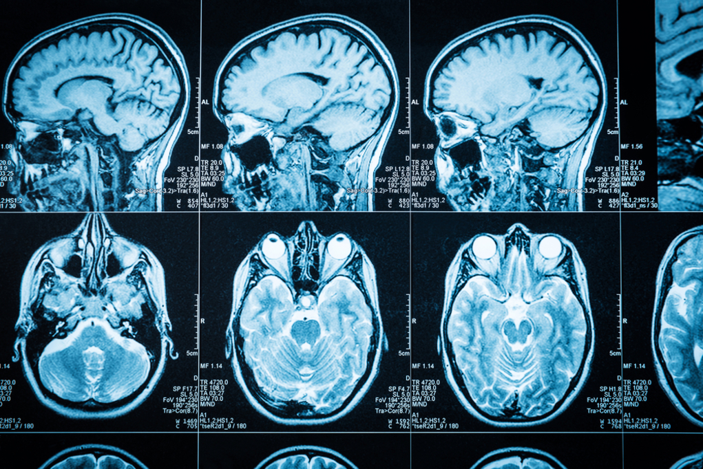 mp Medical Physics can be generally defined as a field in which applied physics is incorporated into medicine.