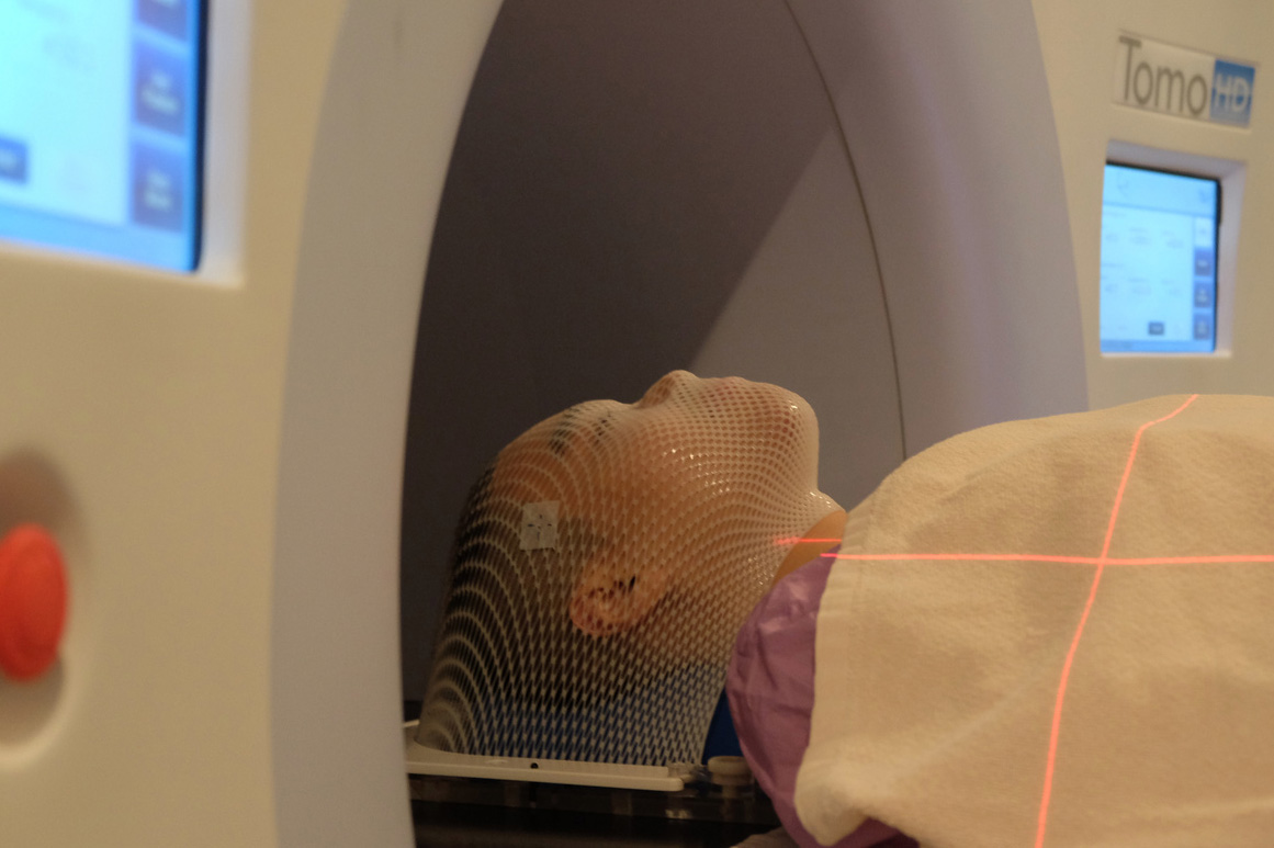  Tomotherapy is an advanced, image-guided, intensity-modulated radiation therapy (IMRT)